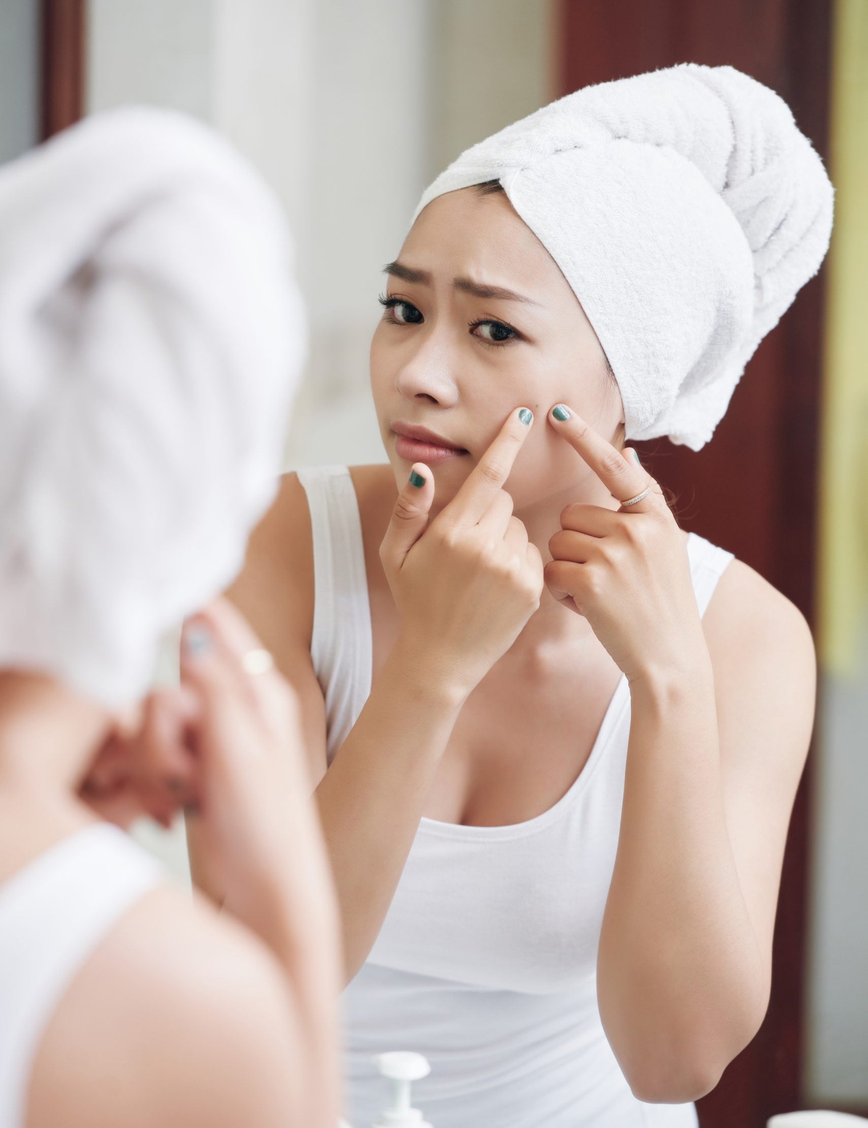 How do hormones cause acne?