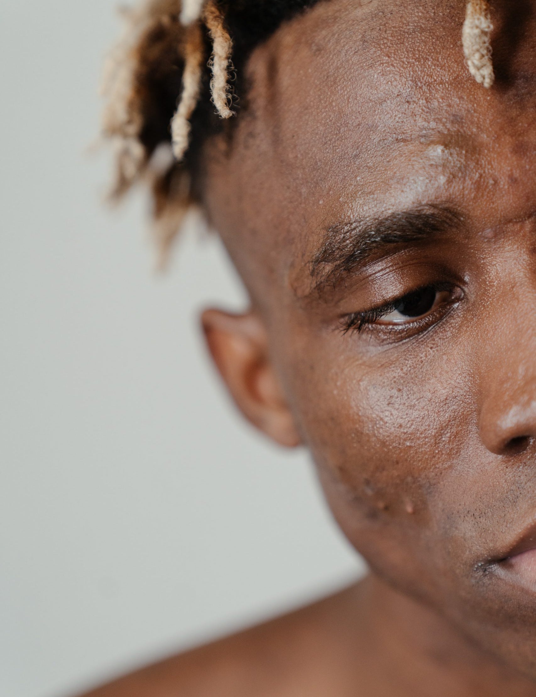 skin type 6 male acne