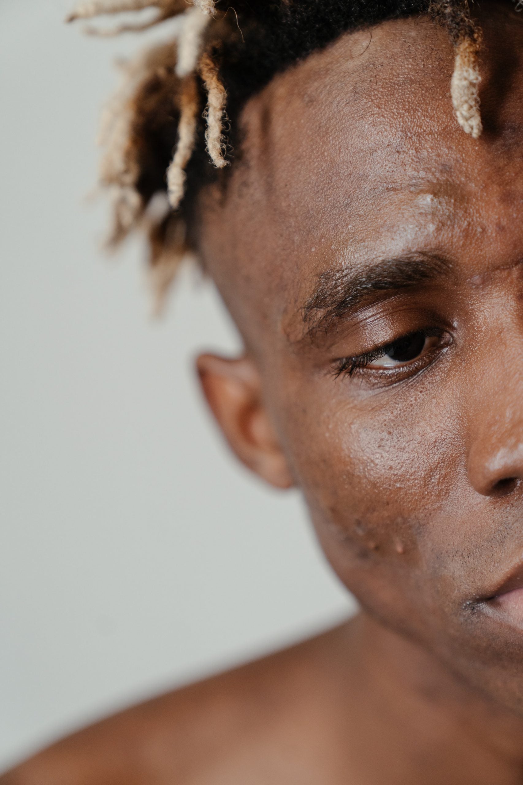 skin type 6 male acne