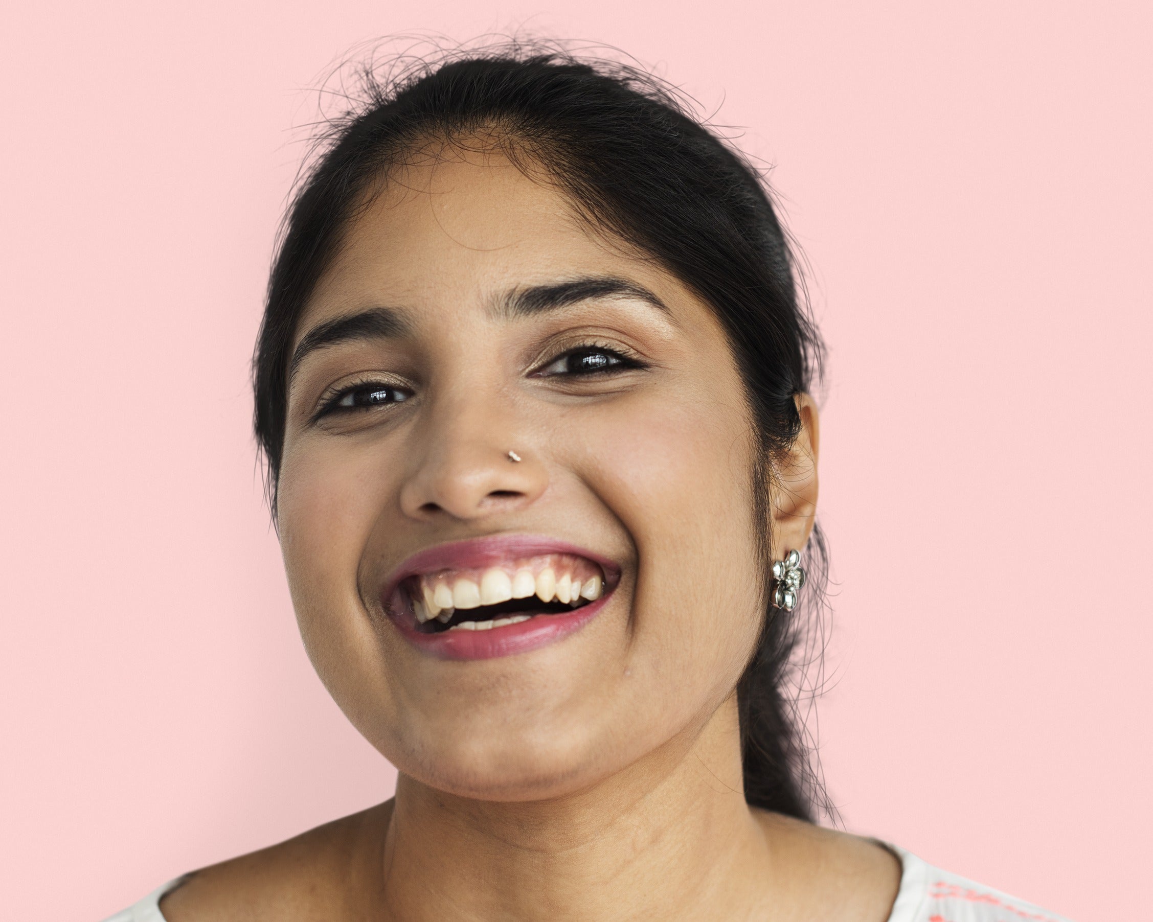 Acne, Scarring and Darker Skin Types