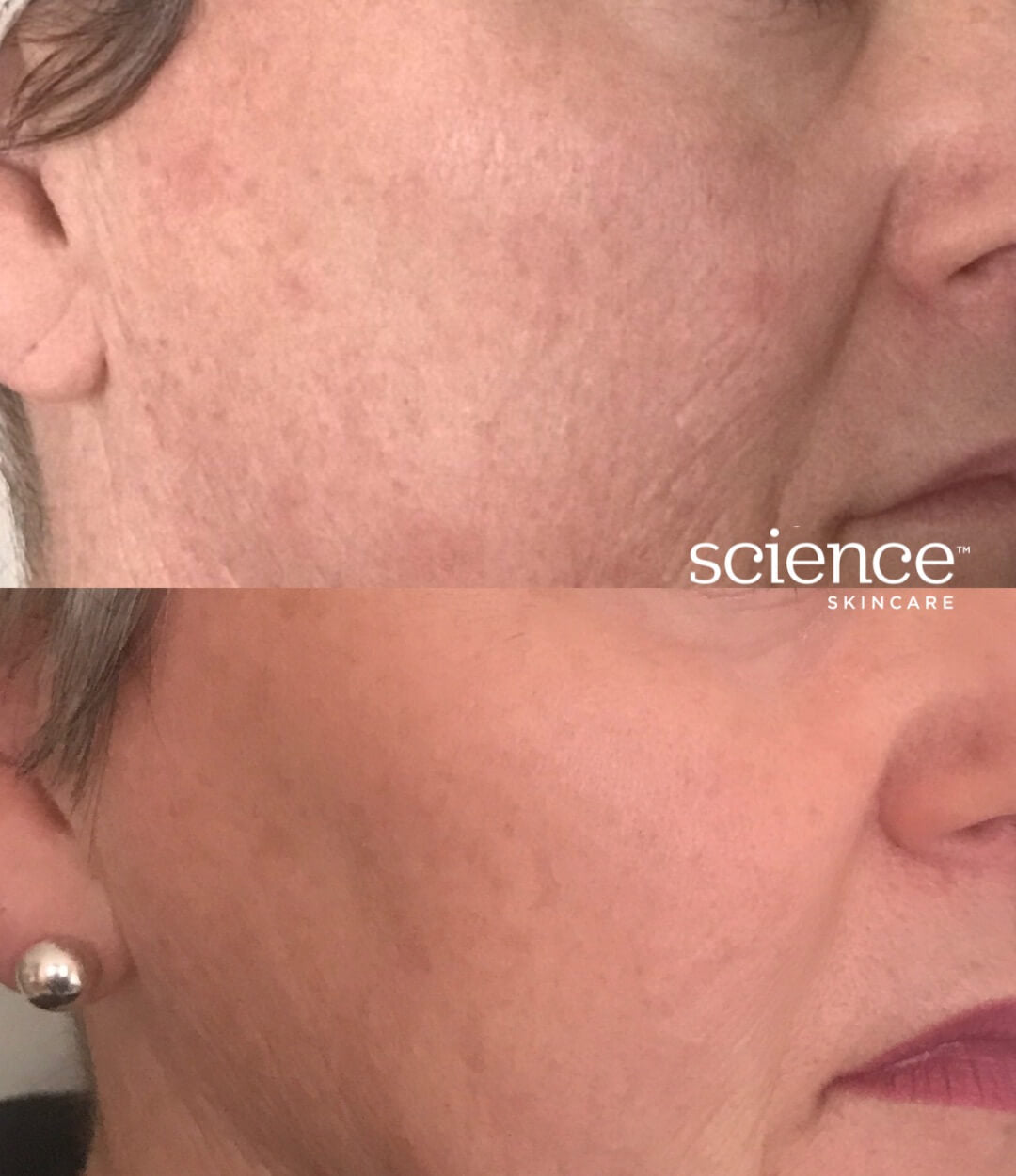 Anti-aging skincare results demonstrating firmer, more hydrated skin with reduced wrinkles