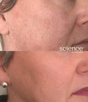 Anti-aging skincare results demonstrating firmer, more hydrated skin with reduced wrinkles