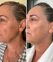Anti-aging skincare results demonstrating firmer, more hydrated skin with reduced wrinkles